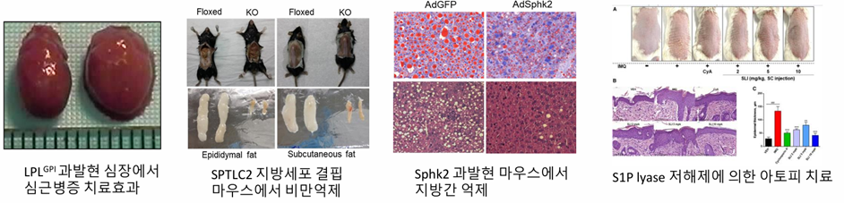 Four experimental result panels: heart tissue comparison, floxed versus knockout mice with epididymal and subcutaneous fat, AdGFP versus AdSphk2 liver histology, and S1P lyase inhibitor dose response in a dermatitis model
